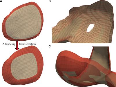 Robust automatic hexahedral cartilage meshing framework enables population-based computational studies of the knee